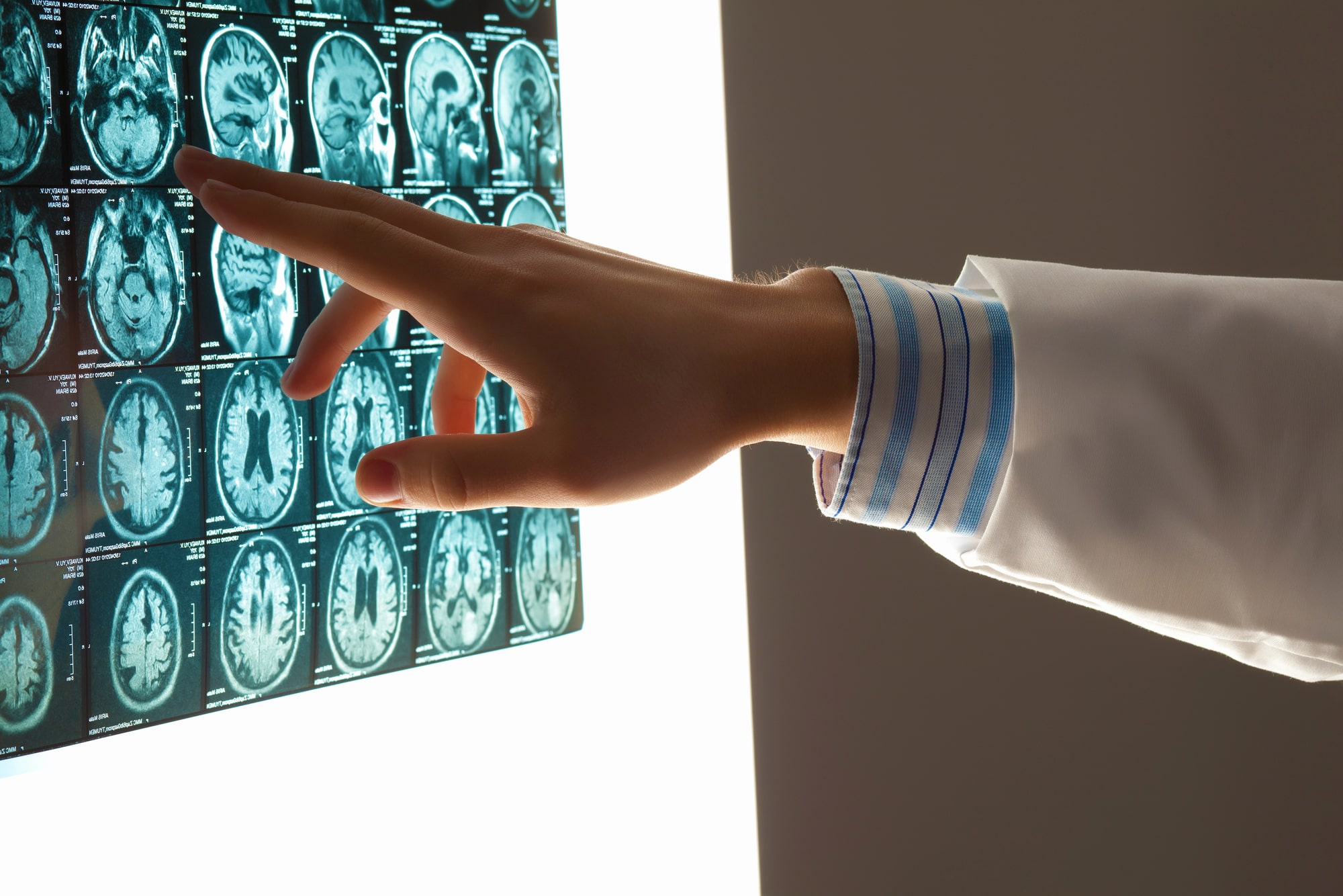 Limited English skills are still a barrier to good medical care