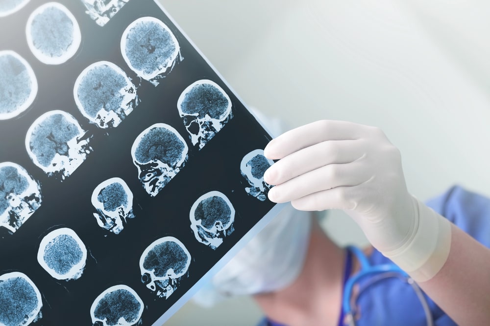 brain injury lawyer Richardson, TX